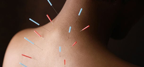 Acupuncture in Fort Lauderdale